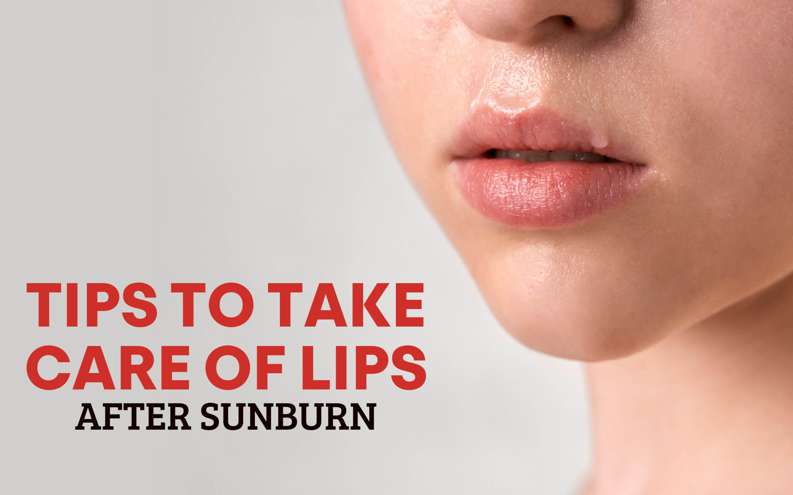 Take Care of Lips after Sunburn